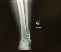 Feeney Trimal Fx photo - LaMarche Safranko Law Feeney Trimal Fx photo